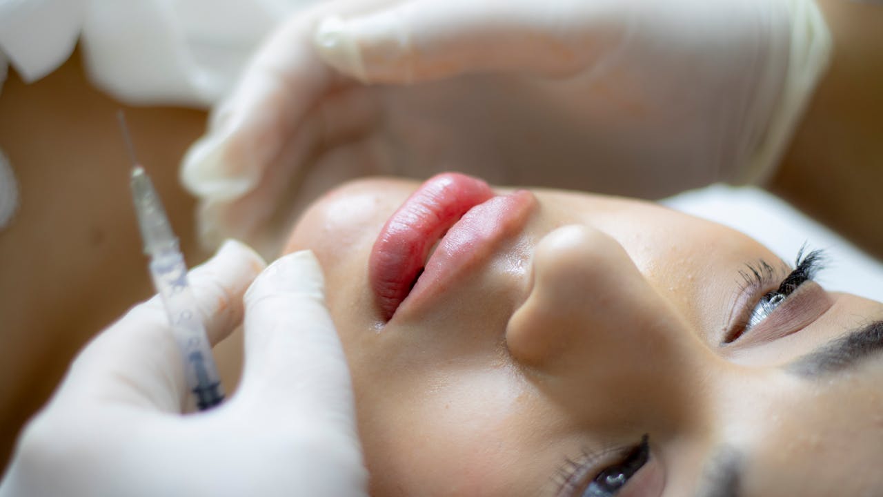 Lip Filler 1507 S. Hiawassee Road, Ste 115, Orlando, FL 32835.